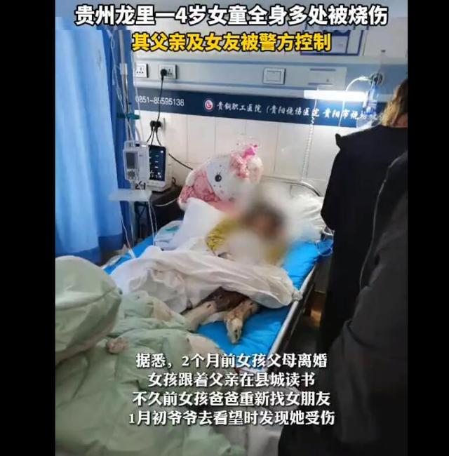全身多处烧伤！4岁女孩被虐待 父亲及其女友被控制休闲区蓝鸢梦想 - Www.slyday.coM