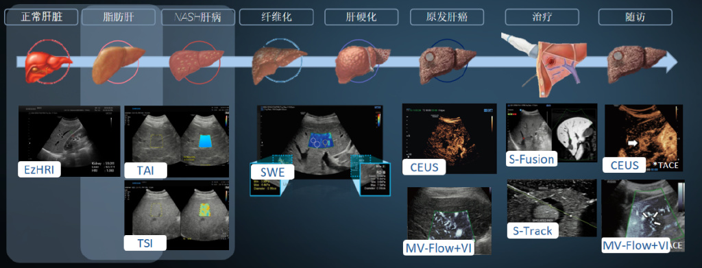 三星超高端彩超中国首发,硬核技术让超声学会“思考”!__财经头条