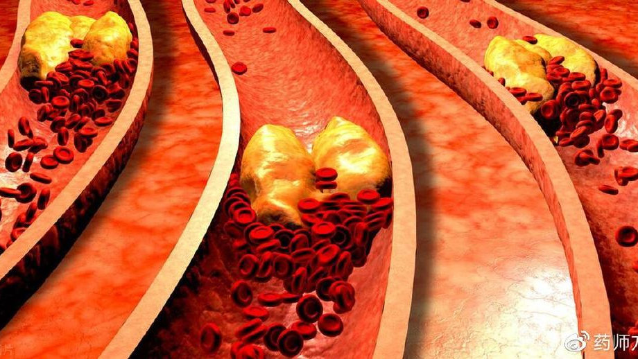 棕榈油是否含反式脂肪酸 食用棕榈油的健康影响