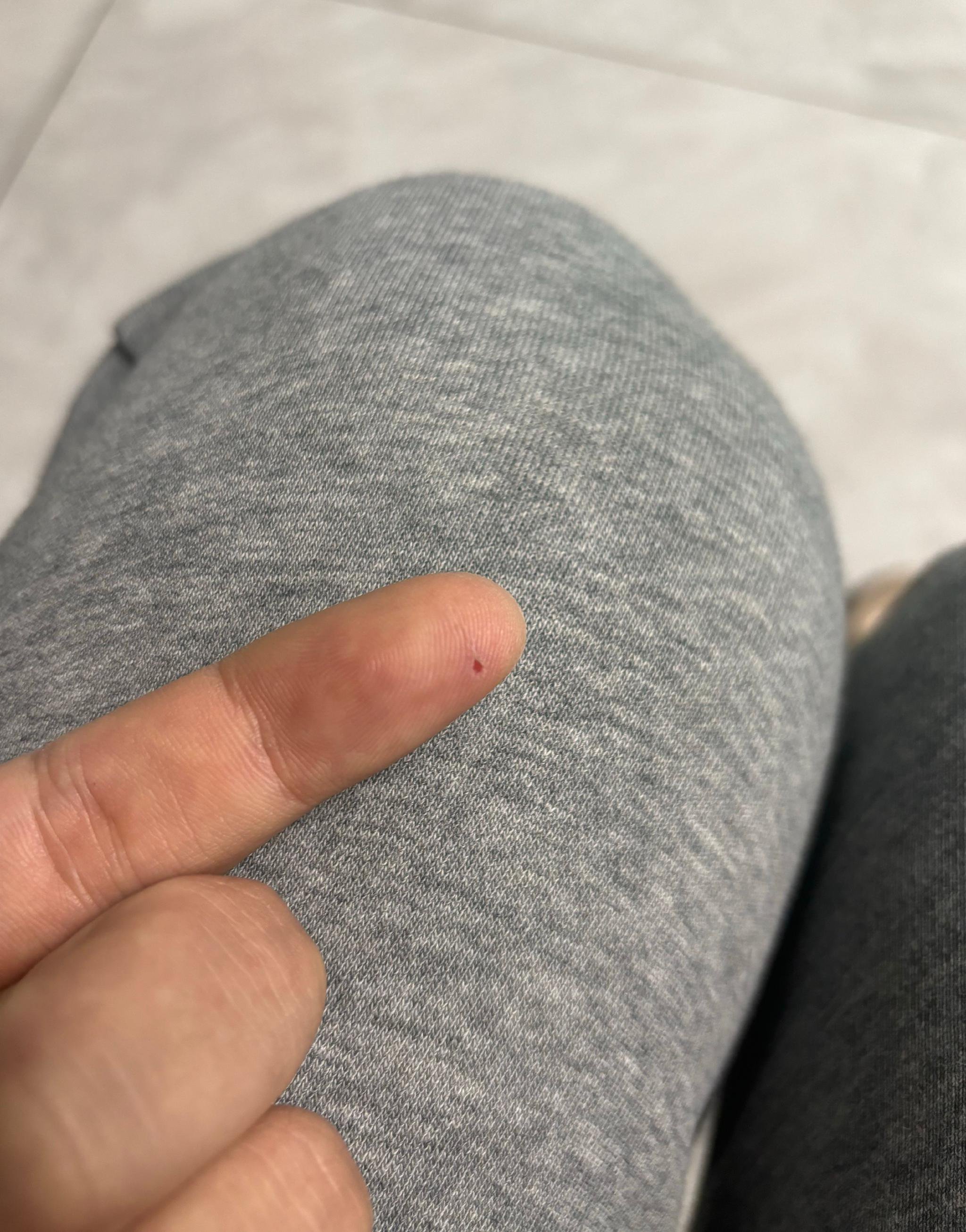 昨晚手指不小心被带锈的铁丝,划伤了一个小伤口…|手指_新浪新闻