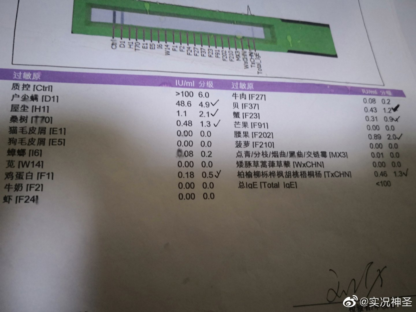 我呼吸暂停综合征肠鸣音亢进脂肪肝