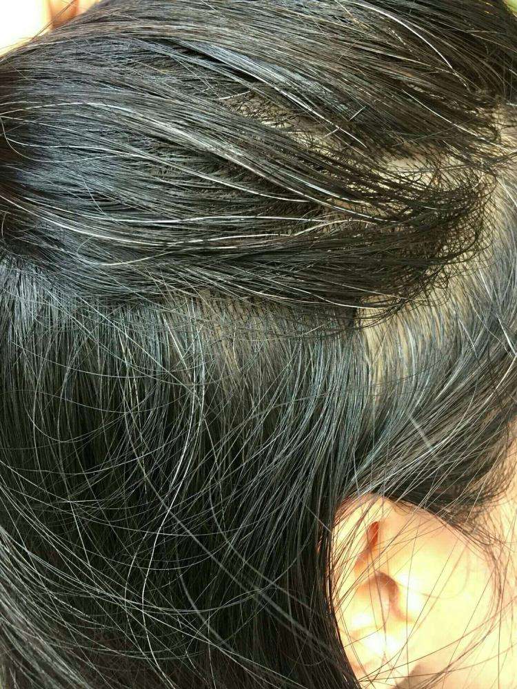 掉发,发质干枯,头发长得慢?专家:很可能是身体缺乏这些元素