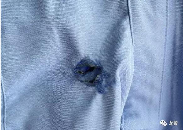 "你这衣服烧破了呀",被群众提醒后,他才忽然感觉到左肩火辣辣的痛