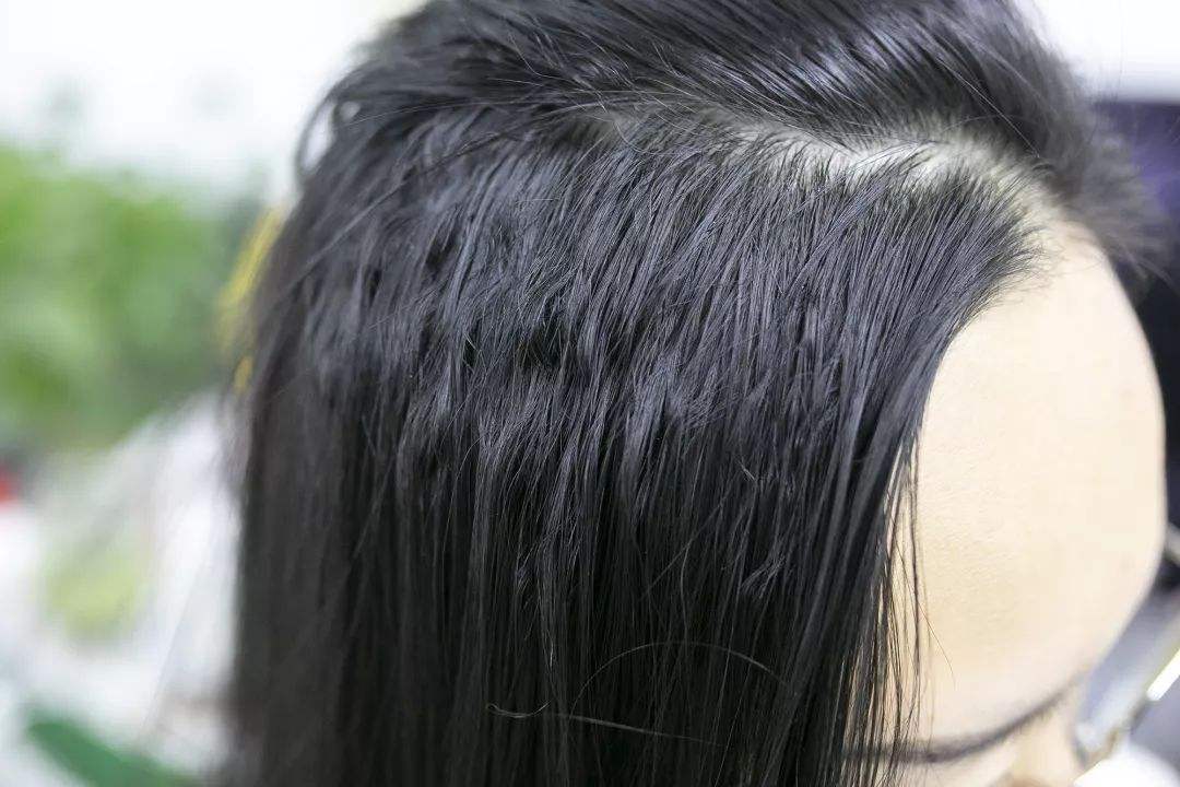 掉发,发质干枯,头发长得慢?专家:很可能是身体缺乏这些元素