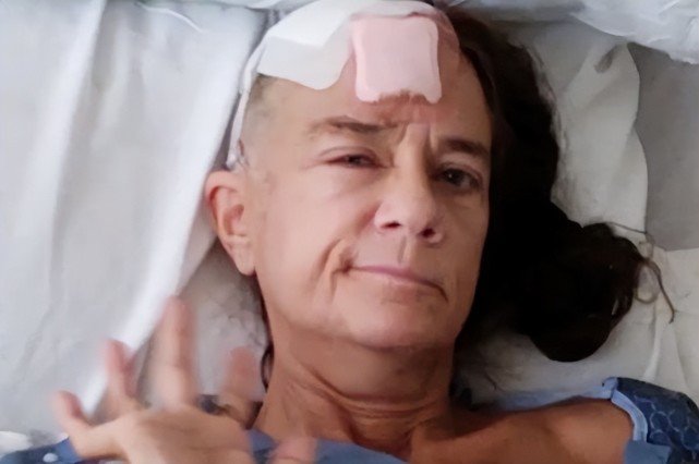 美国女子家中跌倒就医才发现自己头部中弹将近1周