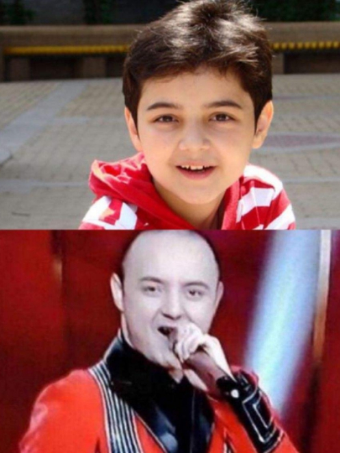 有种"整容"叫阿尔法植发,18岁如同中年大叔,现如今帅到不敢认