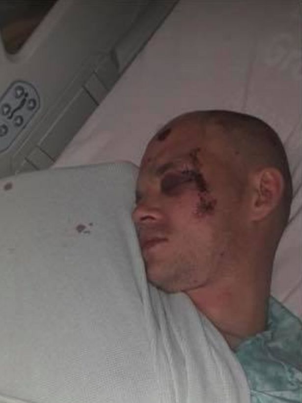 英国男子莫名其妙晕倒在垃圾桶旁鼻青脸肿|斯科特|英国|医院_新浪新闻