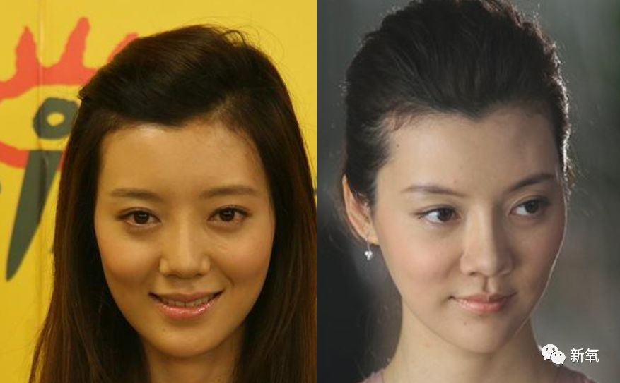 假体|鼻头|车晓_新浪新闻