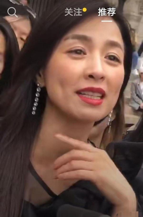 49岁张庭活动生图,眼纹明显面部皮肤松弛,酒窝少女人设崩塌?