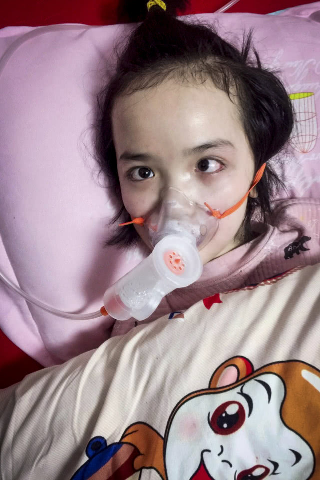 医生告知,女儿需要先处理好脑积水,穿刺脑脊液,穿刺活检术加放化疗