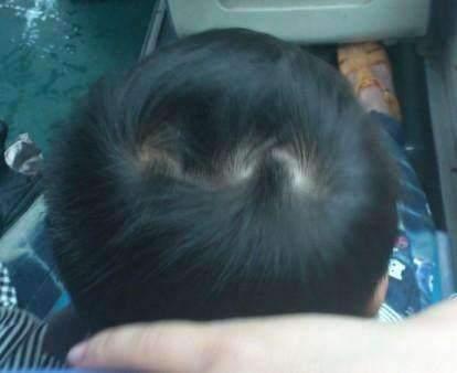 为什么有的孩子头上有"2个旋"?代表什么意思,父母要知道