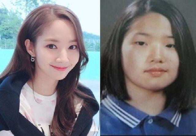 从丑小鸭蜕变为白天鹅,靠整容走上人生巅峰,还是李敏镐前女友