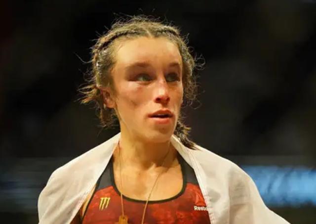 乔安娜额头裹着纱布,波兰人为张伟丽点赞