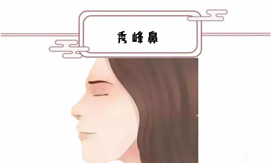 看富在鼻,女人四种“好命”鼻,事业有成,给家里人争光!|鼻子|运势|蒜头_新浪新闻