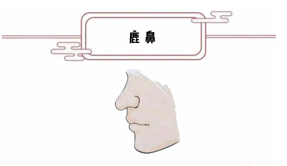 看富在鼻,女人四种“好命”鼻,事业有成,给家里人争光!|鼻子|运势|蒜头_新浪新闻