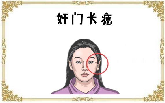 女人5颗"妨夫"痣,婚后拖丈夫后腿,对健康不利!