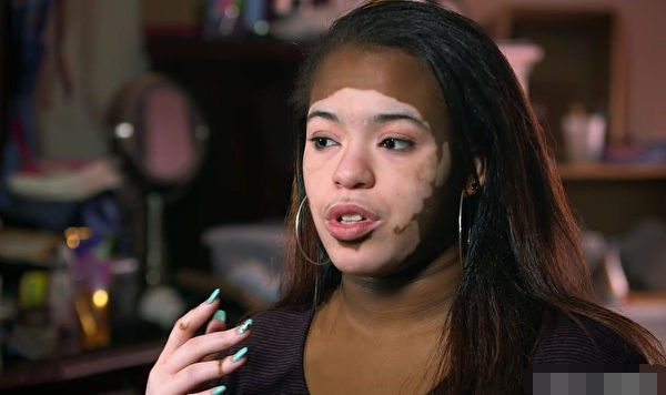 黑人女孩肤色逐渐变白,却5年不卸妆,原因让人感到意外