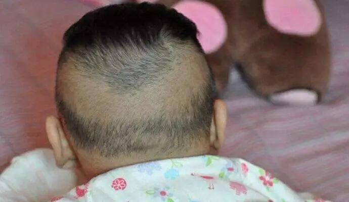 5,婴儿缺钙的表现与症状 宝宝缺钙的症状有哪些 小孩子缺钙有什么症状