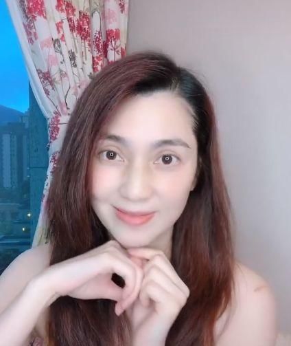 49岁美女洪欣两月没做头发很邋遢胳膊竟有奇怪淤青