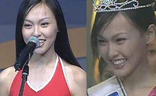 唐嫣18岁选美画面曝光穿泳装侃侃而谈牙齿参差不齐影响美观