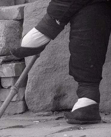 正文         随着改革开放中国的女人不用再裹小脚了,可是在世界上的