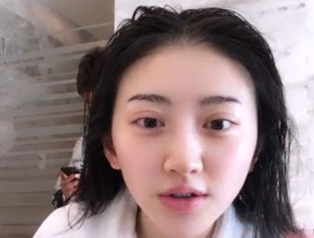 景甜母女档现身整容诊所疑修复菜刀式双眼皮大甜甜又美了