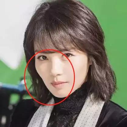 侧脸看突出的部位就是颧骨颧骨过高影响侧面颜值所以我们喜欢把这两块