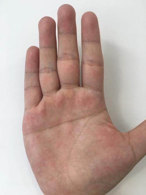 女性无名指下金房子婚姻幸福且一生富贵