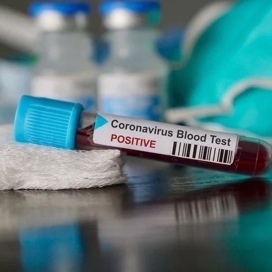 捷克采购的中国检测试剂错误率高达80%？捷克澄