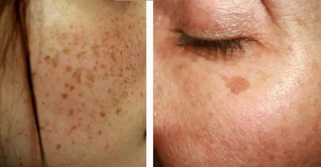 壹知肤:皮肤暗沉多斑的看过来!学会这几招,你也能"逆生长"!