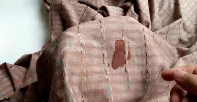 衣物上沾上血渍不易清洗,教你一招,血渍轻松溶解下来