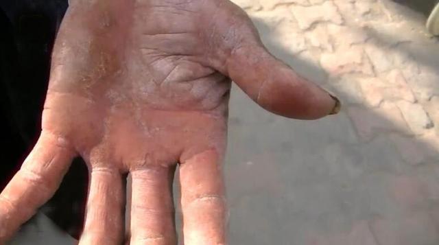 64岁的老人做装卸工,卸40吨货分到100多元,声称不用给孩子要钱