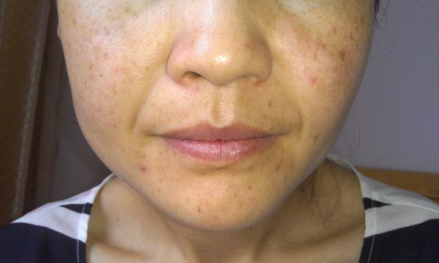 壹知肤:皮肤暗沉多斑的看过来!学会这几招,你也能"逆生长"!