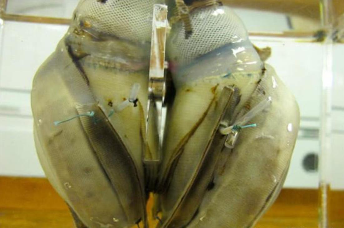 来自5万年前的人造心脏,是史前文明的产物,还是天外来客馈赠?