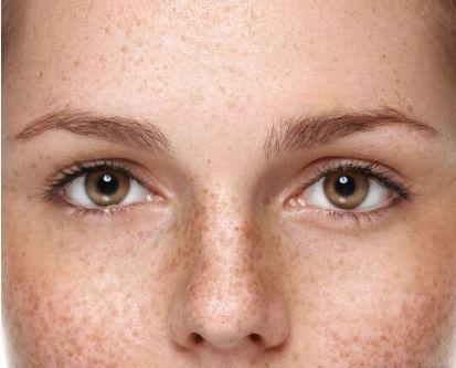 壹知肤:皮肤暗沉多斑的看过来!学会这几招,你也能"逆生长"!|黑色素|雀