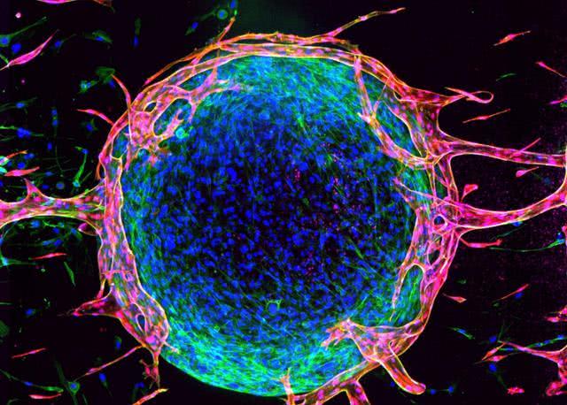 科学家发现其内部结构很像一个微型宇宙|微观世界|宇宙|细胞_新浪新闻