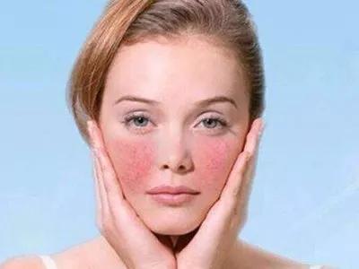 壹知肤换季不慌张关于皮肤屏障那些事你了解多少