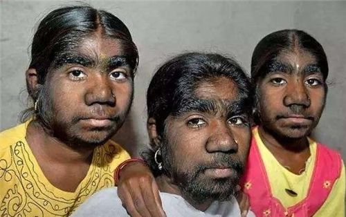 全世界最"奇特"的村庄,全村237人长相一样,科学至今难以解释