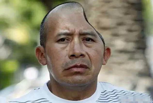 美国男子花了34亿买半边脑袋英国小伙却因半边脑袋走红