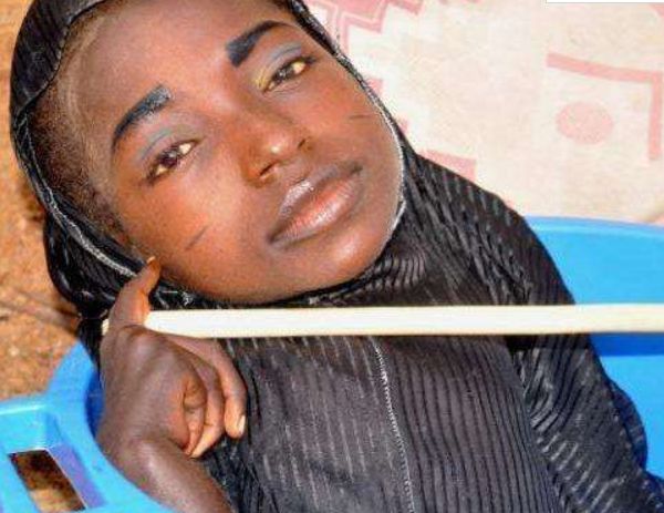 世界上最坚强的女孩,因怪病仅剩一个头部,如今仍坚强活着