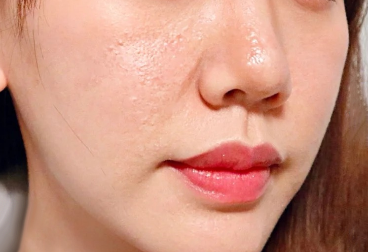 粗大的毛孔,黑头都遮不掉,出了油感觉脸很脏.