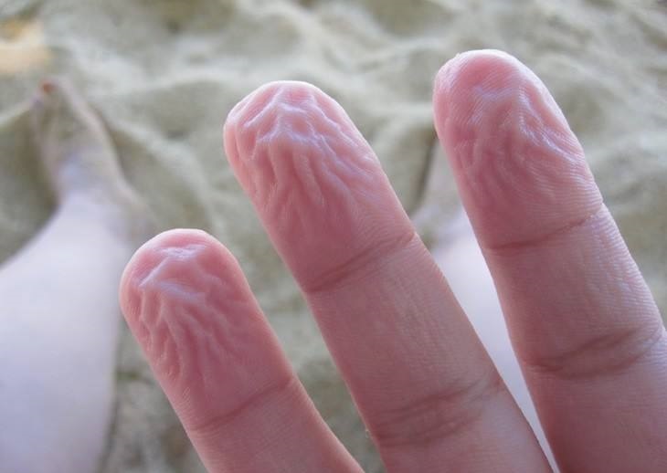 我们的皮肤一泡水就出现褶皱,这是人类来自海洋的证据?