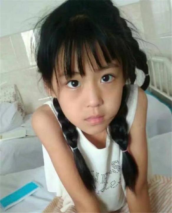 这几种孩子越长大越丑逃不过变丑命运你家孩子中了吗