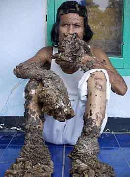 印尼树人"半人半树"|树人|信德|迪德_新浪新闻