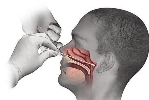 美国女子接受新冠检测痛得呻吟护士将超长棉签插进她鼻孔深处