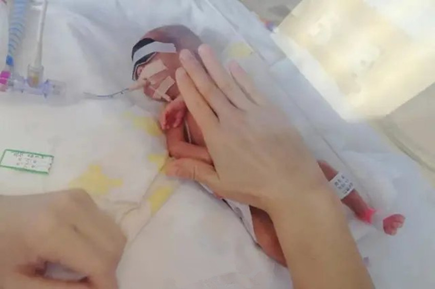 胎龄仅25周零6天!这位妈妈产下极早早产双胞胎,网友:看着心疼