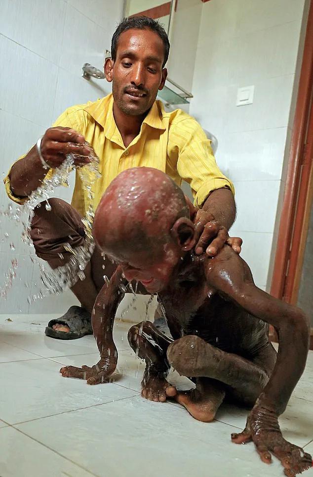 印度饿死小孩图片图片