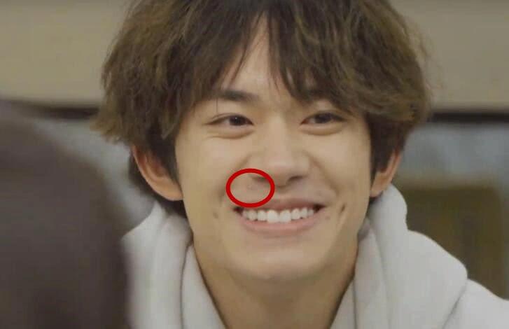 有一种变化叫易烊千玺卸妆,唇周痘痘明显,还是你心中的男神吗?