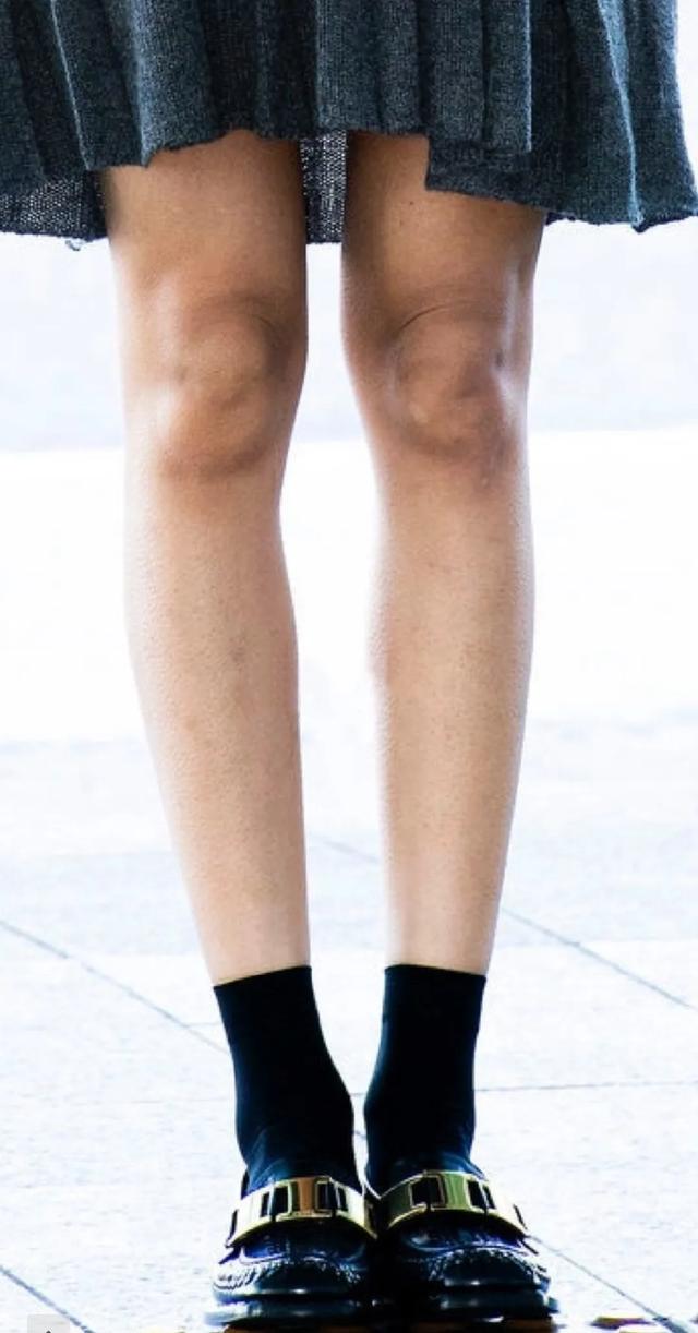 关掉十级美颜后,不敢相信这是lisa的腿.