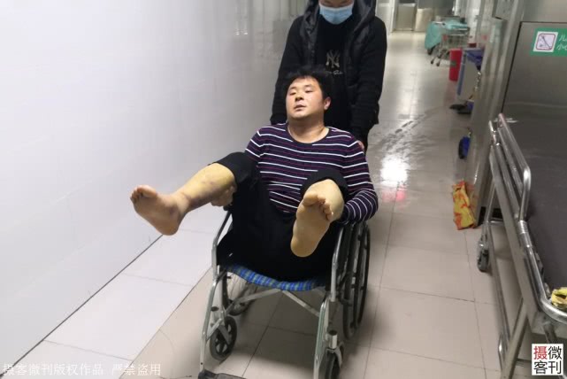 男子为挣200块钱摔断双腿, 真相让人落泪